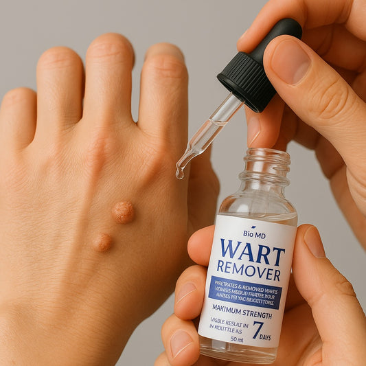 WART REMOVER | ELIMINA VERRUGAS Y LUNARES DE FORMA RÁPIDA Y SEGURA ✅